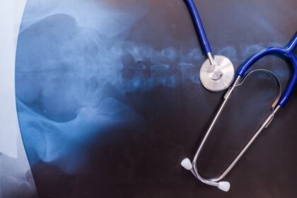 ΑΓΙΟΣ ΛΟΥΚΑΣ ΟΣΤΕΟΠΟΡΩΣΗ ΔΉΜΗΤΡΑ ΜΠΟΓΔΑΝΟΥ