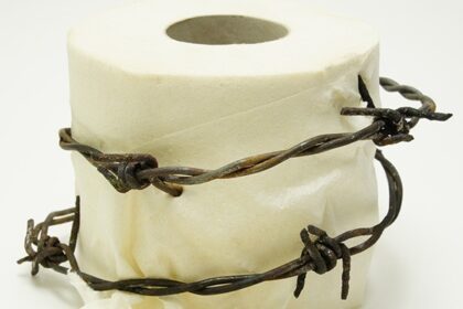 Κύστη-Κόκκυγος-Δρ-Αναστάσιος-Παπαδόπουλος