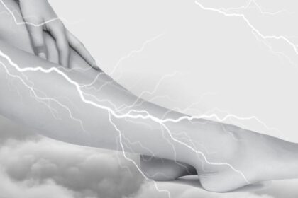 Τριγωνάκης Κωνσταντίνος κιρσοί