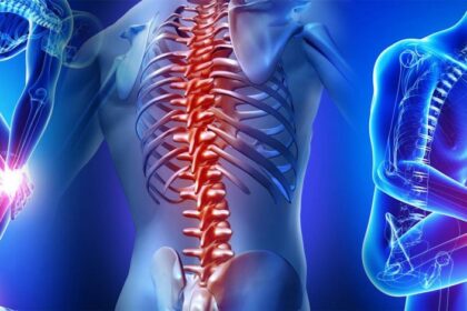 Οστεοπόρωση