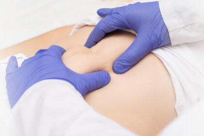 Αποκατάσταση