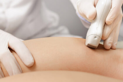 ευρυαγγείες